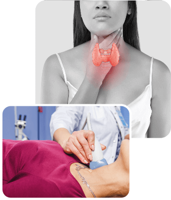 treatment for thyroid gland in women